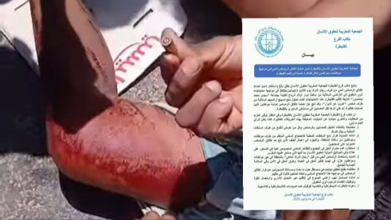بيان حقوقي يثير ملف إطلاق النار خلال احتجاجات الأراضي السلالية بإقليم القنيطرة
