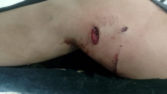 كلاب ضالة تغزو بلدية تارودانت ،مهددة الساكنة وتضيف ضحايا جدد إلى القائمة و شبه جمعيات تعارض محاربتها!!!!…صور حصرية من الحادث…